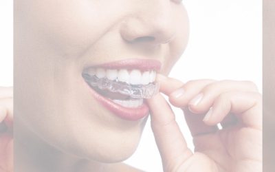Can You Have an Allergic Reaction to Invisalign?
