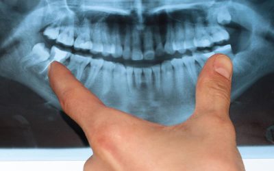 Emergency Dental Services